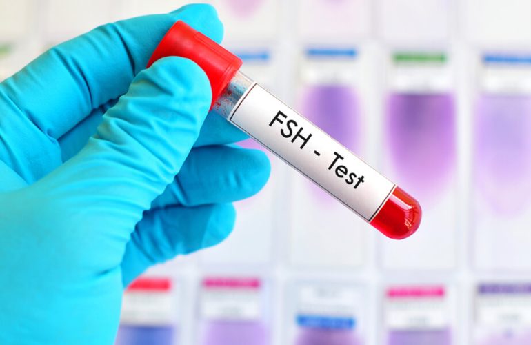 Understanding the Role of FSH (Follicle-Stimulating Hormone)