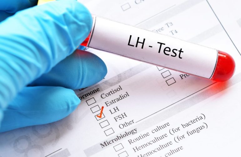 What is LH hormone and What should its levels be
