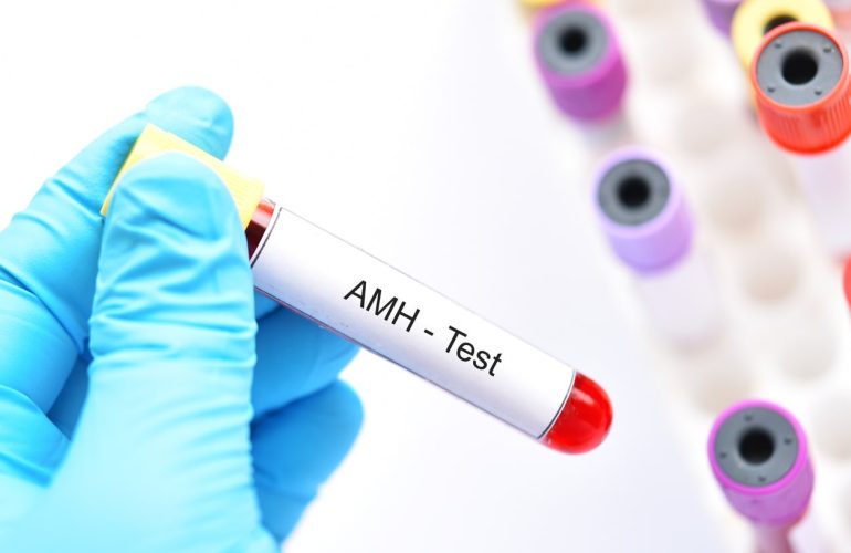 What is an AMH Test