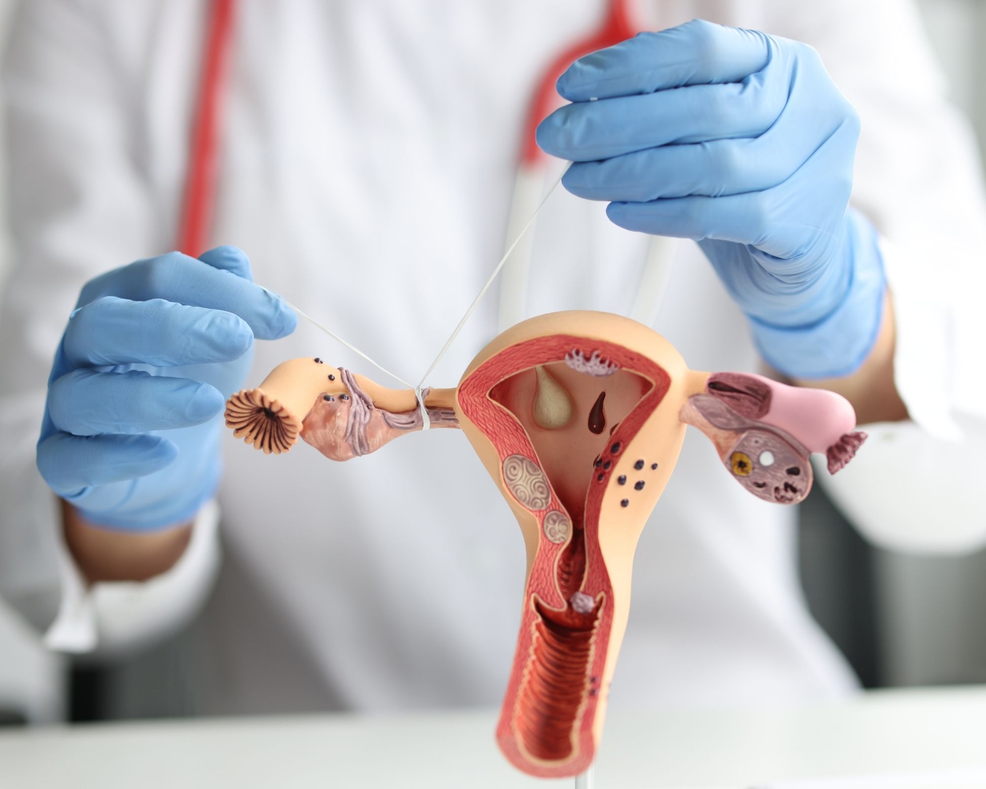 Tubal Blockage Treatment