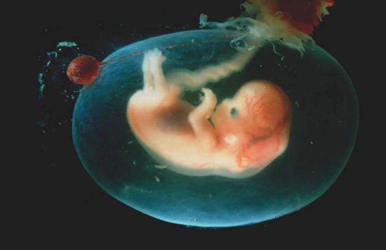 What is the Amniotic Sac