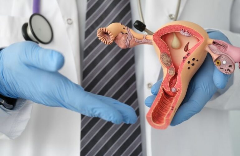 Are Polyps and Fibroids an Obstacle to IVF Treatment