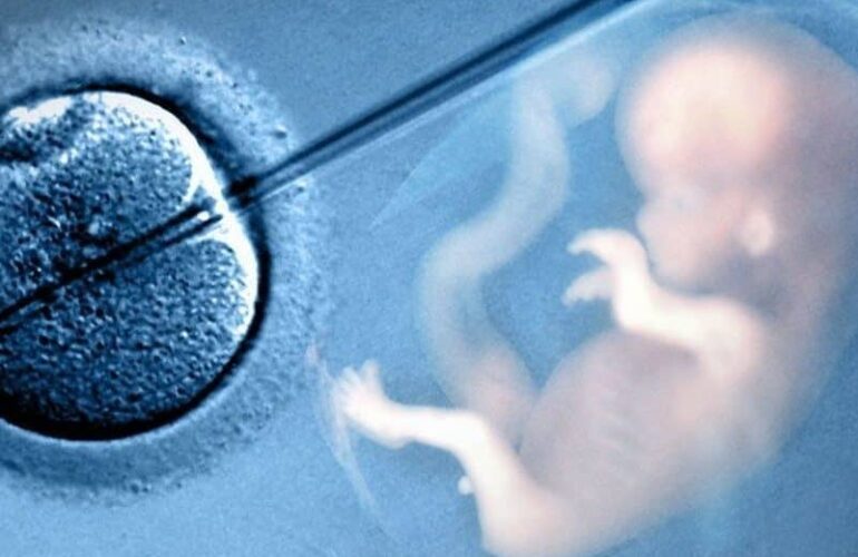 IVF